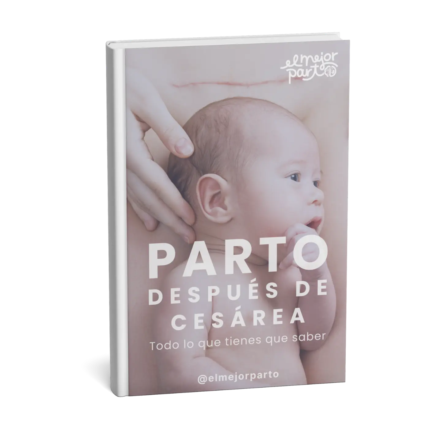 Parto después de cesárea